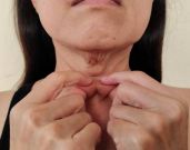 How To Treat Neck Wrinkles? 6 Effective Ways to Treat Them