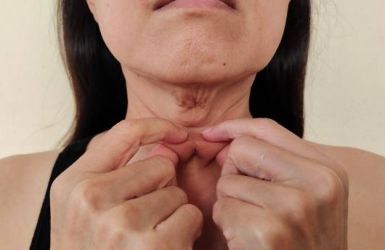 How To Treat Neck Wrinkles? 6 Effective Ways to Treat Them